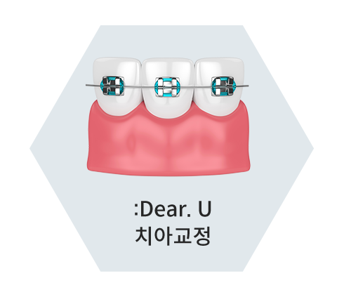 치아교정