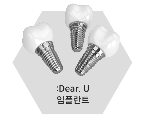 임플란트